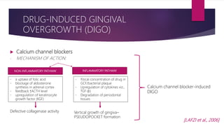  Calcium channel blockers
- MECHANISM OF ACTION:
DRUG-INDUCED GINGIVAL
OVERGROWTH (DIGO)
NON-INFLAMMATORY PATHWAY INFLAMMATORY PATHWAY
- ↓ uptake of folic acid
- blockage of aldosterone
synthesis in adrenal cortex
- feedback ↑ACTH level
- upregulation of keratinocyte
growth factor (KGF)
Defective collagenase activity
- ↑local concentration of drug in
GCF/bacterial plaque
- Upregulation of cytokines viz.,
TGF-β1
- Degradation of periodontal
tissues
Vertical growth of gingiva–
PSEUDOPOCKET formation
Calcium channel blocker-induced
DIGO
[LAFZI et al., 2006]
 