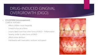 CYCLOSPORINE (Immunosuppressant)
- CLINICAL FEATURES:
- Affects children more frequently
- Limited to buccal surfaces
- Lesions bleed more than other forms of DIGO-- ↑inflammation
- Severity similar to other forms of DIGO
- Affects entire dentition
- Interference with mastication, occlusion and speech
DRUG-INDUCED GINGIVAL
OVERGROWTH (DIGO)
 