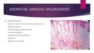  HISTOPATHOLOGY
- bulbous increase in the amount of connective tissue
- relatively avascular
- densely arranged collagen bundles
- numerous fibroblasts
- Thickening of surface epithelium
- Acanthosis
- Elongation of rete pegs
IDIOPATHIC GINGIVAL ENLARGEMENT
 