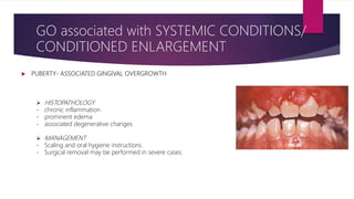  PUBERTY- ASSOCIATED GINGIVAL OVERGROWTH
- occurs in both male and female adolescents – areas of plaque accumulation.
 CLINICAL FEATURES:
- size of the gingival enlargement greatly exceeds that usually seen in association with
comparable local factors
- marginal and interdental
- characterized by prominent bulbous interproximal papillae
- Capnocytophaga and P. intermedia [MOMBELLI et al., 1990; WOJCICKI CJ, 1987]
- mechanical action of the tongue and the excursion of food prevent a heavy
accumulation of local irritants on the lingual surface.
- tendency to develop massive recurrence in the presence of relatively scant plaque
deposits
- undergoes spontaneous reduction but does not disappear until plaque and calculus
are removed.
GO associated with SYSTEMIC CONDITIONS/
CONDITIONED ENLARGEMENT
 HISTOPATHOLOGY
- chronic inflammation
- prominent edema
- associated degenerative changes
 MANAGEMENT
- Scaling and oral hygiene instructions.
- Surgical removal may be performed in severe cases.
 
