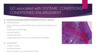  NUTRITION-ASSOCIATED GINGIVAL OVERGROWTH (Vitamin C Deficiency)
 HISTOPATHOLOGY:
- chronic inflammatory cellular infiltration with a superficial acute response in the
gingiva
- scattered areas of hemorrhage
- engorged capillaries
- marked diffuse edema
- collagen degeneration, and scarcity of collagen fibrils or fibroblasts
► MANAGEMENT:
- changes in nutrition
- nonsurgical treatment
- good oral hygiene– rare cases surgical removal
GO associated with SYSTEMIC CONDITIONS/
CONDITIONED ENLARGEMENT
 