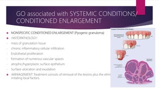  NONSPECIFIC CONDITIONED ENLARGEMENT (Pyogenic granuloma)
 HISTOPATHOLOGY:
- mass of granulation tissue
- chronic inflammatory cellular infiltration
- Endothelial proliferation
- formation of numerous vascular spaces
- atrophic/hyperplastic surface epithelium
- Surface ulceration and exudation
 MANAGEMENT: Treatment consists of removal of the lesions plus the elimination of
irritating local factors.
GO associated with SYSTEMIC CONDITIONS/
CONDITIONED ENLARGEMENT
 