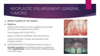  BENIGN TUMORS OF THE GINGIVA
 Papilloma
- benign proliferations of surface epithelium associated
with the human papillomavirus (HPV).
- Viral subtypes HPV-6 and HPV-11
- solitary, wartlike or cauliflower-like protuberances
- small and discrete or broad, hard elevations with
irregular surfaces.
 HISTOPATHOLOGY. The papilloma lesion consists of
fingerlike projections of stratified squamous epithelium,
often hyperkeratotic, with a central core of fibrovascular
connective tissue.
NEOPLASTIC ENLARGEMENT (GINGIVAL
TUMORS)
 