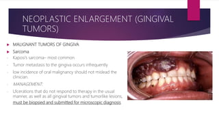 MALIGNANT TUMORS OF GINGIVA
 Sarcoma
- Kaposi’s sarcoma– most common
- Tumor metastasis to the gingiva occurs infrequently
- low incidence of oral malignancy should not mislead the
clinician.
- MANAGEMENT:
- Ulcerations that do not respond to therapy in the usual
manner, as well as all gingival tumors and tumorlike lesions,
must be biopsied and submitted for microscopic diagnosis
NEOPLASTIC ENLARGEMENT (GINGIVAL
TUMORS)
 