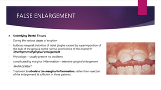 FALSE ENLARGEMENT
 Underlying Dental Tissues
- During the various stages of eruption
- bulbous marginal distortion of labial gingiva caused by superimposition of
the bulk of the gingiva on the normal prominence of the enamel
Developmental gingival enlargement.
- Physiologic-- usually present no problems
- complicated by marginal inflammation-- extensive gingival enlargement
- MANAGEMENT:
- Treatment to alleviate the marginal inflammation, rather than resection
of the enlargement, is sufficient in these patients.
 