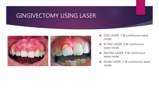 GINGIVECTOMY USING LASER
 CO2 LASER: 7 W continuous wave
mode
 Er:YAG LASER: 3 W continuous
wave mode
 Nd:YAG LASER: 4 W continuous
wave mode
 Diode LASER: 2 W continuous wave
mode
 