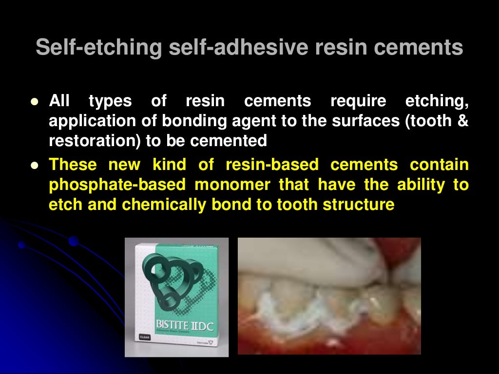 glass ionomer MetalModified GIC ResinModified GIC dental material