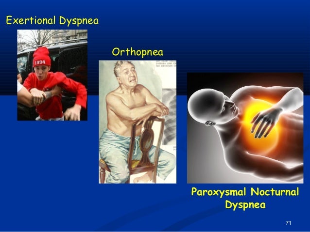orthopnea paroxysmal nocturnal dyspnea orthopnea paroxysmal nocturnal dyspnea