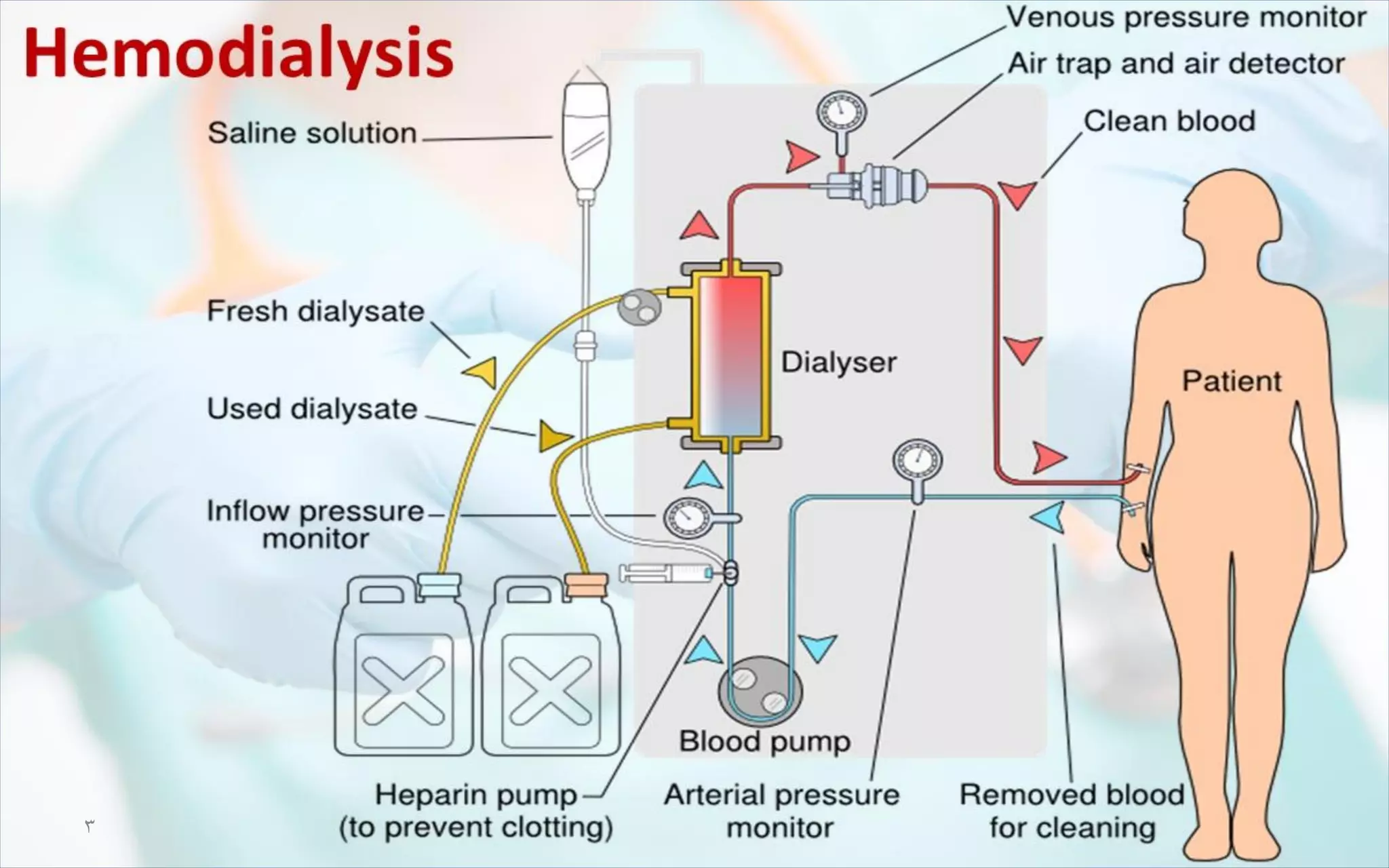 10 Hemodialysis Msn Pdf