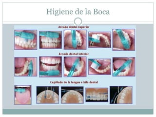 Higiene de la Boca
 