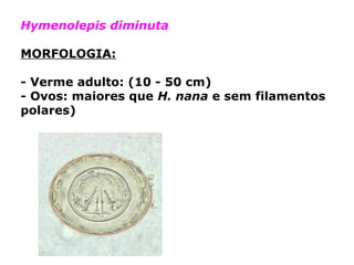Hymenolepis diminuta
MORFOLOGIA:
- Verme adulto: (10 - 50 cm)
- Ovos: maiores que H. nana e sem filamentos
polares)
 