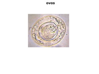 ovos
 