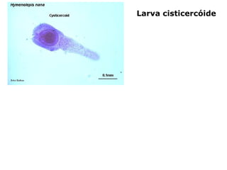 Larva cisticercóide
 