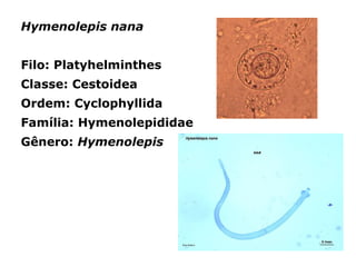 Hymenolepis nana
Filo: Platyhelminthes
Classe: Cestoidea
Ordem: Cyclophyllida
Família: Hymenolepididae
Gênero: Hymenolepis
 
