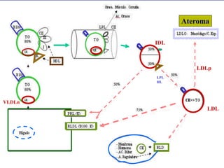 IDL
LDL
LPL
HL
VLDLn
LDLp
Ateroma
 