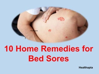 Healthapta
Healthapta
10 Home Remedies for
Bed Sores
 