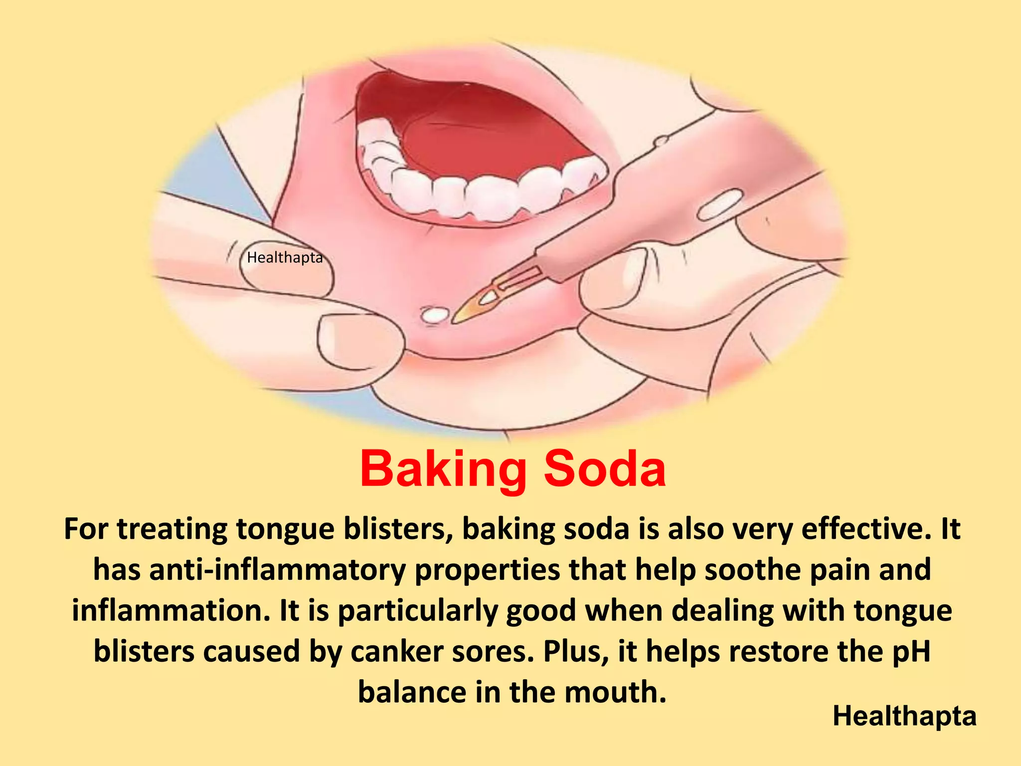 10 Home Remedies for Blisters on Tongue | PPTX | Ear, Nose and Throat