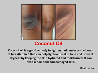 Healthapta
Coconut Oil
Coconut oil is a good remedy to lighten dark knees and elbows.
It has vitamin E that can help lighten the skin tone and prevent
dryness by keeping the skin hydrated and moisturized. It can
even repair dark and damaged skin.
Healthapta
 
