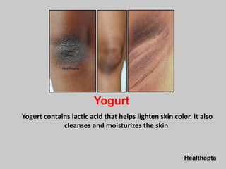 Healthapta
Yogurt
Yogurt contains lactic acid that helps lighten skin color. It also
cleanses and moisturizes the skin.
Healthapta
 
