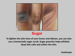 Healthapta
Sugar
To lighten the skin tone of your knees and elbows, you can also
use a homemade sugar scrub. Sugar granules help exfoliate
dead skin cells and soften the skin.
Healthapta
 