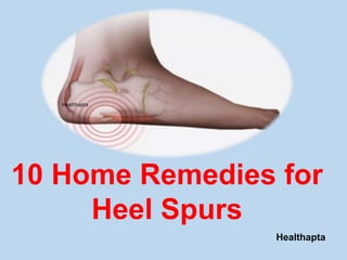 Healthapta
Healthapta
10 Home Remedies for
Heel Spurs
 