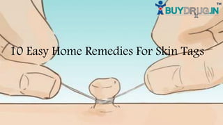 10 Easy Home Remedies For Skin Tags
 