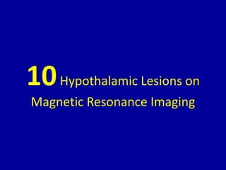 10Hypothalamic Lesions on
Magnetic Resonance Imaging
 