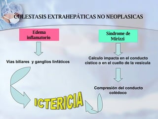 Edema inflamatorio  Vías biliares  y ganglios linfáticos  Síndrome de Mirizzi  Calculo impacta en el conducto cistico o en el cuello de la vesícula  Compresión del conducto colédoco  ICTERICIA  COLESTASIS EXTRAHEPÁTICAS NO NEOPLASICAS 