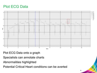 Plot ECG Data onto a graph
Specialists can annotate charts
Abnormalities highlighted
Potential Critical Heart conditions can be averted
34
Plot ECG Data
 