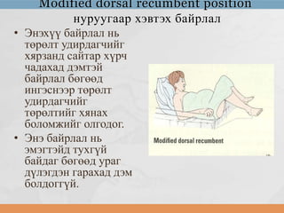 Modified dorsal recumbent position
нуруугаар хэвтэх байрлал
• Энэхүү байрлал нь
төрөлт удирдагчийг
хярзанд сайтар хүрч
чадахад дэмтэй
байрлал бөгөөд
ингэснээр төрөлт
удирдагчийг
төрөлтийг хянах
боломжийг олгодог.
• Энэ байрлал нь
эмэгтэйд тухгүй
байдаг бөгөөд ураг
дүлэгдэн гарахад дэм
болдоггүй.

 