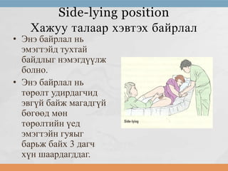 Side-lying position
Хажуу талаар хэвтэх байрлал

• Энэ байрлал нь
эмэгтэйд тухтай
байдлыг нэмэгдүүлж
болно.
• Энэ байрлал нь
төрөлт удирдагчид
эвгүй байж магадгүй
бөгөөд мөн
төрөлтийн үед
эмэгтэйн гуяыг
барьж байх 3 дагч
хүн шаардагддаг.

 