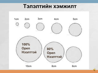 Тэлэлтийн хэмжилт
1cm

2cm

100%
Open
Нээлттэй

10cm

3cm

4cm

5cm

80%
Open
Нээлттэй
8cm

6cm

 