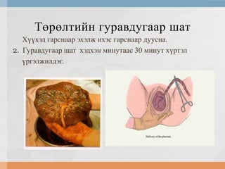 Төрөлтийн гуравдугаар шат
Хүүхэд гарснаар эхэлж ихэс гарснаар дуусна.
2. Гуравдугаар шат хэдхэн минутаас 30 минут хүртэл
үргэлжилдэг.

 