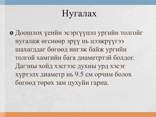 Нугалах


Доошлох үеийн эсэргүүцэл ургийн толгойг
нугалаж өгснөөр эрүү нь цээжрүүгээ
шахагддаг бөгөөд ингэж байж ургийн
толгой хамгийн бага диаметртэй болдог.
Дагзны хойд хэсгээс духны урд хэсэг
хүртэлх диаметр нь 9.5 см орчим болох
бөгөөд төрөх зам цухуйн гарна.

 