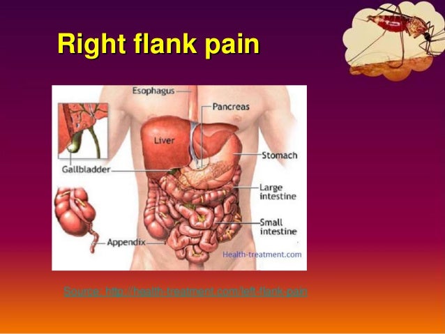 Left flank pain – Causes, symptoms, diagnosis and treatment Left flank pain – Causes, symptoms, diagnosis and treatment