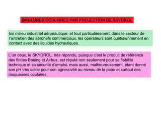 BRULURES OCULAIRES PAR PROJECTION DE SKYDROL
En milieu industriel aéronautique, et tout particulièrement dans le secteur de
l’entretien des aéronefs commerciaux, les opérateurs sont quotidiennement en
contact avec des liquides hydrauliques.
L’un deux, le SKYDROL, très répandu, puisque c’est le produit de référence
des flottes Boeing et Airbus, est réputé non seulement pour sa fiabilité
technique et sa sécurité d’emploi, mais aussi, malheureusement, étant donné
son pH très acide pour son agressivité au niveau de la peau et surtout des
muqueuses oculaires
 