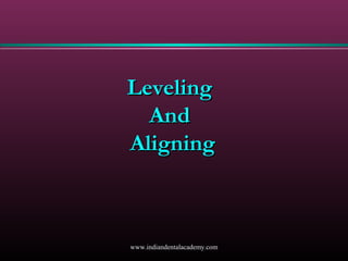 Leveling
And
Aligning

www.indiandentalacademy.com

 