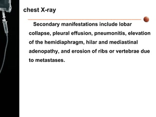 chest X-ray Secondary manifestations include lobar collapse, pleural effusion, pneumonitis, elevation of the hemidiaphragm, hilar and mediastinal adenopathy, and erosion of ribs or vertebrae due to metastases. 