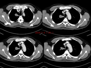 2008 年 8 月 28 日 