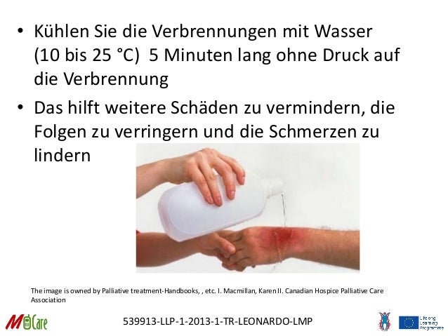 Wie Lange Kühlen Bei Verbrennungen www.slideshare.net