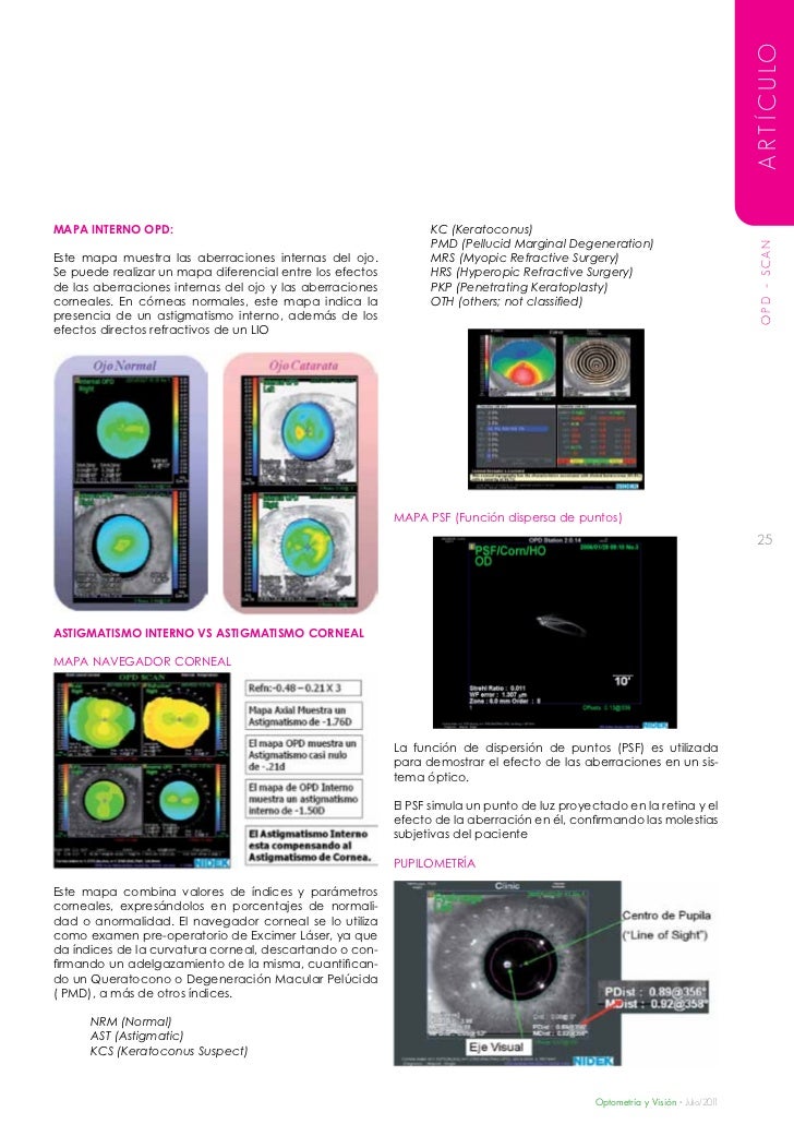 Optometría y Visión 10ma edición Julio/11