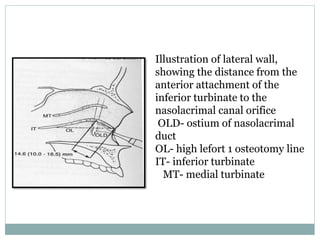 Illustration of lateral wall,
showing the distance from the
anterior attachment of the
inferior turbinate to the
nasolacrimal canal orifice
OLD- ostium of nasolacrimal
duct
OL- high lefort 1 osteotomy line
IT- inferior turbinate
MT- medial turbinate
 