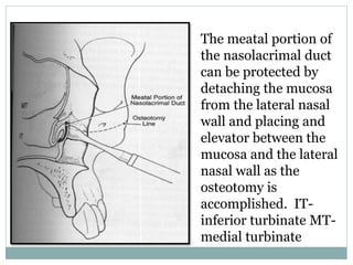 The meatal portion of
the nasolacrimal duct
can be protected by
detaching the mucosa
from the lateral nasal
wall and placing and
elevator between the
mucosa and the lateral
nasal wall as the
osteotomy is
accomplished. IT-
inferior turbinate MT-
medial turbinate
 