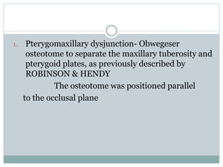 1. Pterygomaxillary dysjunction- Obwegeser
osteotome to separate the maxillary tuberosity and
pterygoid plates, as previously described by
ROBINSON & HENDY
The osteotome was positioned parallel
to the occlusal plane
 