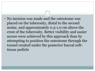  No incision was made and the osteotome was
placed on the tuberosity, distal to the second
molar, and approximately 0.5-1.0 cm above the
crest of the tuberosity. Better visibility and easier
access were achieved by this approach than by
attempting to position the osteotome through the
tunnel created under the posterior buccal soft-
tissue pedicle
 