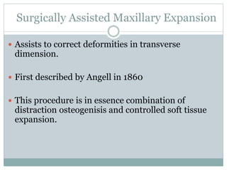 Surgically Assisted Maxillary Expansion
 Assists to correct deformities in transverse
dimension.
 First described by Angell in 1860
 This procedure is in essence combination of
distraction osteogenisis and controlled soft tissue
expansion.
 