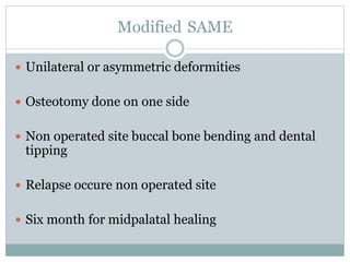 Modified SAME
 Unilateral or asymmetric deformities
 Osteotomy done on one side
 Non operated site buccal bone bending and dental
tipping
 Relapse occure non operated site
 Six month for midpalatal healing
 