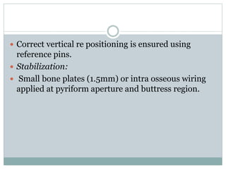  Correct vertical re positioning is ensured using
reference pins.
 Stabilization:
 Small bone plates (1.5mm) or intra osseous wiring
applied at pyriform aperture and buttress region.
 