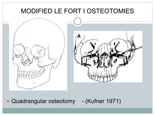 MODIFIED LE FORT I OSTEOTOMIES
 Quadrangular osteotomy - (Kufner 1971)
 