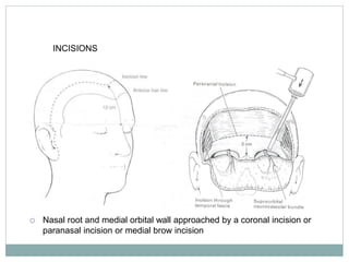 INCISIONS
 Nasal root and medial orbital wall approached by a coronal incision or
paranasal incision or medial brow incision
 